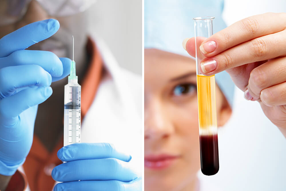Getting a P-shot for male enhancement is one of the best things that you can do