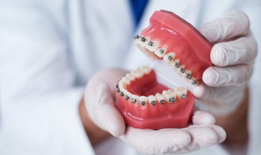 Orthodontic conditions