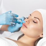 dermal fillers