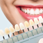 Is It Possible to Improve the Appearance of Your Teeth?