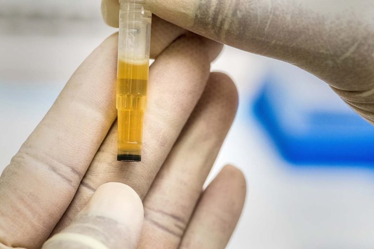 syntheticurine1 (3)